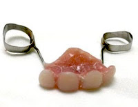 Pediatric Dental Partial appliance